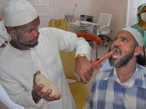 Görseldeki Yapılan diş çekimi yöntemini nasıl buluyorsunuz:))??