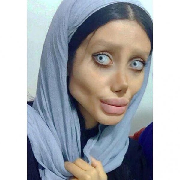 Angelina Jolie ye benzemeye çalışan İranlı kadının son hali işte...!
