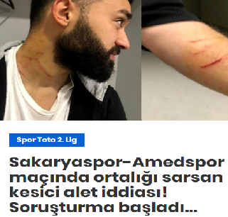 Sakaryaspor- Amedspor maçında sahaya kesici alet ile giren futbolcu, rakip oyuncuları çaktırmadan yaraladı. Detayları biliyor musunuz?
