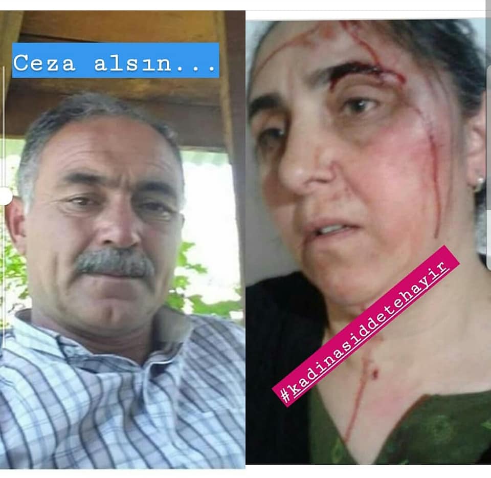 Kars'ta eşinden şiddet göre bu kadının yaşadıklarına inanamayacaksınız. Lütfen siz de paylaşır mısınız?