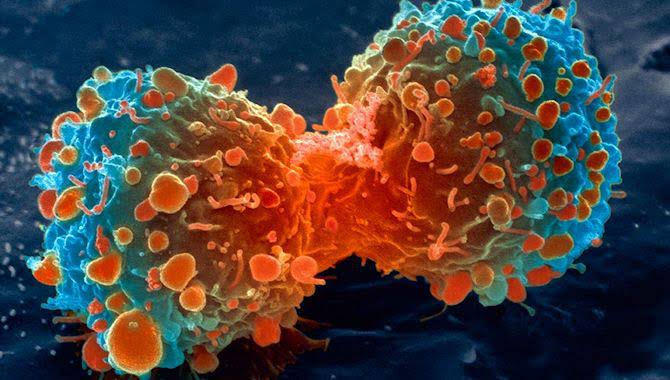 Kanser hücresi neden oluşur?