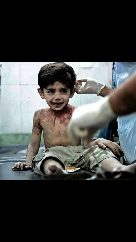 Bu savaşlarda büyük hasar görenler topraklar mı yoksa masum çocuklar mı?