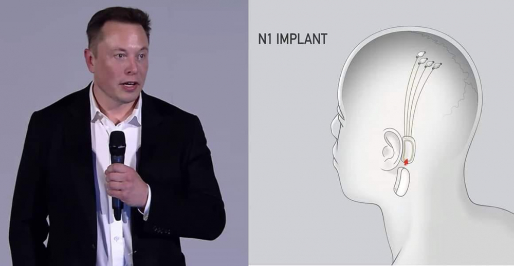 Elon Musk yeni projesini tanıttı. Artık beynimizle telefonumuzu düşünerek kontrol edebileceğiz. Nasıl mı? Açıklamada..