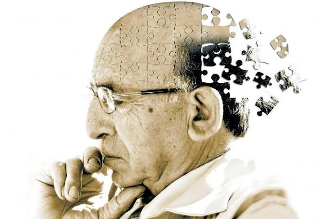 Alzheimer Tedavisi var mı ?